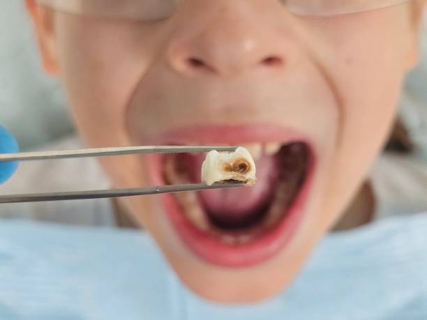 Best Emergency Cosmetic Dentistry (e.g., broken veneers) in St Anthony, ID